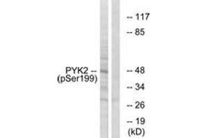 Western Blotting (WB) image for anti-PTK2B Protein tyrosine Kinase 2 beta (PTK2B) (AA 369-418), (pTyr402) antibody (ABIN1531957) (PTK2B 抗体  (pTyr402))