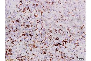 Formalin-fixed and paraffin embedded mouse lung labeled with Rabbit Anti PRAME Polyclonal Antibody, Unconjugated (ABIN721555) at 1:200 followed by conjugation to the secondary antibody and DAB staining (PRAME 抗体  (AA 151-250))