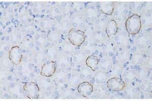 Immunohistochemistry of paraffin-embedded Rat kidney using Aquaporin 4 Polyclonal Antibody at dilution of 1:50 (40x lens). (Aquaporin 4 抗体)
