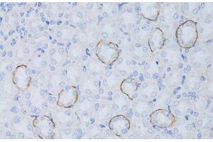 Immunohistochemistry of paraffin-embedded Rat kidney using Aquaporin 4 Polyclonal Antibody at dilution of 1:50 (40x lens).