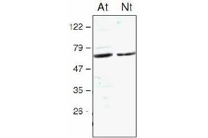 Western blot analysis of Arabidopsis thaliana (At) and Nicotiana tabacum (Nt) chloroplast proteins with anti-STN7 kinase (STN7 Kinase 抗体)