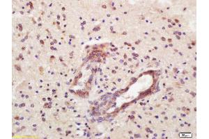 Immunohistochemistry (Paraffin-embedded Sections) (IHC (p)) image for anti-Fc gamma RII (CD32) (AA 201-300) antibody (ABIN742260)