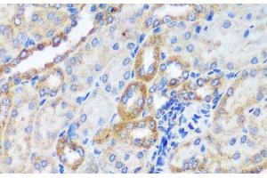 Immunohistochemistry of paraffin-embedded Mouse kidney using ERK1 / ERK2 Polyclonal Antibody at dilution of 1:200 (40x lens). (ERK1/2 抗体)