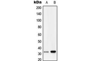 Western blot analysis of RRAD expression in HepG2 (A), human lung (B) whole cell lysates. (RRAD 抗体  (Center))
