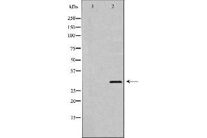 Western blot analysis of extracts of SW620 , using HOXA9 antibody. (HOXA9 抗体  (Internal Region))