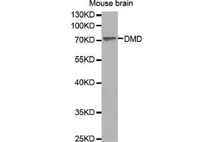 Western Blotting (WB) image for anti-Dystrophin (DMD) (AA 346-635) antibody (ABIN1679546) (Dystrophin 抗体  (AA 346-635))