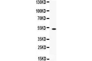 Western blot analysis of FCGRT expression in mouse liver extract (lane 1). (FcRn 抗体  (AA 54-291))