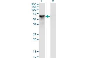 Western Blot analysis of SF1 expression in transfected 293T cell line by SF1 monoclonal antibody (M01A), clone 2E12. (Splicing Factor 1 抗体  (AA 1-110))