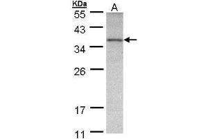 WB Image Sample (30 ug of whole cell lysate) A: A431 , 12% SDS PAGE antibody diluted at 1:500 (OTC 抗体)
