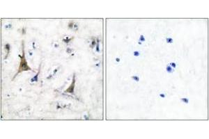 Immunohistochemistry analysis of paraffin-embedded human brain tissue, using PGP9. (UCHL1 抗体  (AA 171-220))