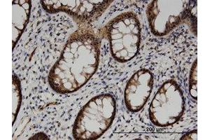 Image no. 1 for anti-Acyl-CoA Thioesterase 7 (ACOT7) (AA 1-339) antibody (ABIN599527) (ACOT7 抗体  (AA 1-339))