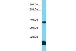 Host: Rabbit Target Name: TAS2R3 Sample Type: Fetal Kidney lysates Antibody Dilution: 1. (TAS2R3 抗体  (Middle Region))