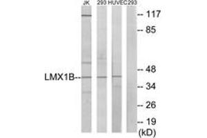 Western blot analysis of extracts from Jurkat/293/HuvEc cells, using LMX1B Antibody. (LMX1B 抗体  (AA 126-175))