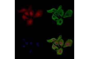 ABIN7093232 and ABIN7097244 staining Hela cells(heat shock treatment) by IF/ICC.