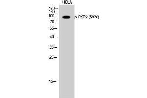 Western Blotting (WB) image for anti-Polycystic Kidney Disease 2 (Autosomal Dominant) (PKD2) (pSer876) antibody (ABIN3182238) (PKD2 抗体  (pSer876))