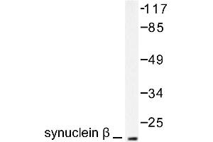 Image no. 1 for anti-Synuclein, beta (SNCB) antibody (ABIN271836) (beta Synuclein 抗体)