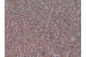 DAB staining on IHC-P; Samples: Rat Spinal cord Tissue (NPR3 抗体  (AA 45-467))