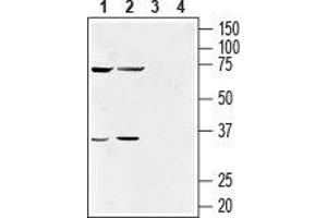 Western blot analysis of human NK-92MI natural killer cell (lanes 1 and 3) (1:500) and human acute monocytic leukemia THP-1 cell (lanes 2 and 4) (1:200) lysates: - 1, 2. (GPR55 抗体  (Extracellular))