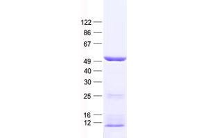 Validation with Western Blot (KRT20 Protein (His tag))