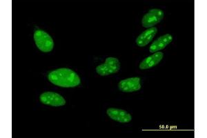 Immunofluorescence of purified MaxPab antibody to H1FX on HeLa cell. (H1FX 抗体  (AA 1-213))