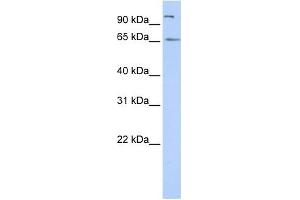 SPATA16 antibody used at 1 ug/ml to detect target protein. (SPATA16 抗体  (N-Term))