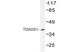 Image no. 1 for anti-Pleckstrin Homology-Like Domain, Family A, Member 1 (PHLDA1) antibody (ABIN317621) (PHLDA1 抗体)
