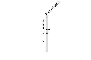 Anti-HOXA7 Antibody (Center) at 1:2000 dilution + Human skeletal muslce lysate Lysates/proteins at 20 μg per lane. (HOXA7 抗体  (AA 82-114))