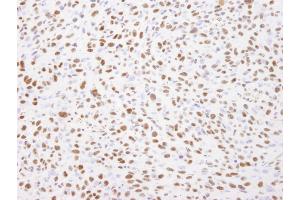 Immunohistochemistry (IHC) image for anti-Nucleolin (NCL) (C-Term) antibody (ABIN7448702)