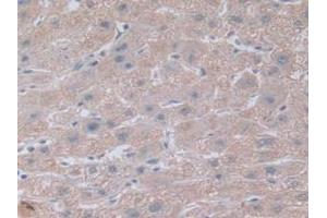 Immunohistochemistry (IHC) image for anti-Notch 4 (NOTCH4) (AA 1715-2001) antibody (ABIN7442495)
