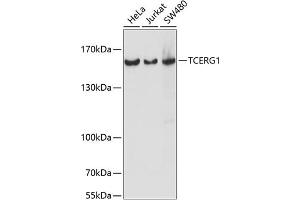 Western blot analysis of extracts of various cell lines, using TCERG1 antibody (ABIN7270879) at 1:1000 dilution. (TCERG1 抗体  (AA 550-650))