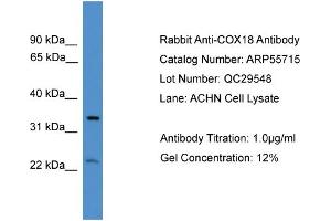 WB Suggested Anti-COX18  Antibody Titration: 0. (COX18 抗体  (Middle Region))