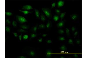 Immunofluorescence of monoclonal antibody to ZIC4 on HeLa cell. (ZIC4 抗体  (AA 249-319))