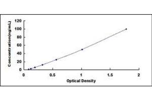 Glutamic Acid Decarboxylase Antibody (GAD Ab) ELISA Kit