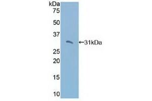 Detection of Recombinant TRADD, Human using Polyclonal Antibody to TNFRSF1A Associated Via Death Domain Protein (TRADD)