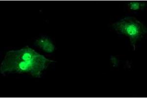 Anti-SDS mouse monoclonal antibody (ABIN2455363) immunofluorescent staining of COS7 cells transiently transfected by pCMV6-ENTRY SDS (RC217814). (serine Dehydratase 抗体)