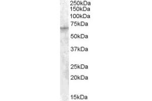 Image no. 1 for anti-Insulin-Like Growth Factor 2 mRNA Binding Protein 2 (IGF2BP2) (C-Term) antibody (ABIN374940) (IGF2BP2 抗体  (C-Term))