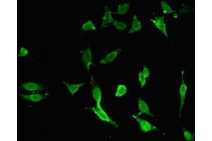 Immunofluorescent analysis of Hela cells using ABIN7173772 at dilution of 1:100 and Alexa Fluor 488-congugated AffiniPure Goat Anti-Rabbit IgG(H+L) (TNFAIP3 抗体  (AA 97-183))