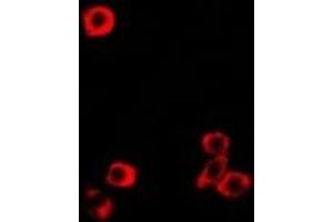 Immunofluorescent analysis of RBP2 staining in MCF7 cells. (RBP2 抗体)