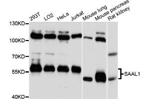 Western blot analysis of extracts of various cell lines, using SAAL1 antibody (ABIN6293922) at 1:3000 dilution. (SAAL1 抗体)