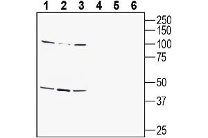 Western blot analysis of human  monocytic leukemia cell line lysate (lanes 1 and 4), human Jurkat T-cell leukemia cell line lysate (lanes 2 and 5) and human SH-SY5Y neuroblastoma cell line lysate (lanes 3 and 6):1-3.