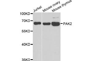 Western blot analysis of extracts of various cell lines, using PAK2 antibody. (PAK2 抗体)