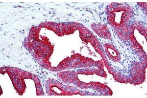 Human Prostate: Formalin-Fixed, Paraffin-Embedded (FFPE)