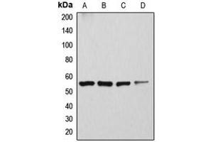 Western blot analysis of ATP6V1H expression in Caki1 (A), SKNSH (B), rat kidney (C), mouse brain (D) whole cell lysates. (ATP6V1H 抗体  (Center))