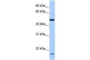 Western Blotting (WB) image for anti-Zinc Finger Protein 764 (ZNF764) antibody (ABIN2458207) (ZNF764 抗体)
