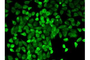 Immunofluorescence analysis of A549 cell using CASP3 antibody. (Caspase 3 抗体  (AA 55-160))