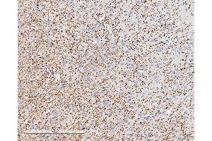 anti-MBP antibody