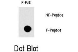 Dot blot analysis of RAF1 (phospho S296) polyclonal antibody  on nitrocellulose membrane. (RAF1 抗体  (pSer296))