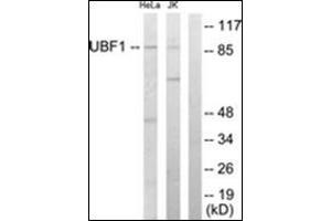 Western blot analysis of extracts from HeLa/Jurkat cells, using UBF1 Antibody . (UBTF 抗体  (Internal Region))