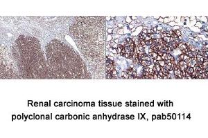 Image no. 1 for anti-Carbonic Anhydrase IX (CA9) (AA 400-500), (C-Term) antibody (ABIN363423) (CA9 抗体  (C-Term))