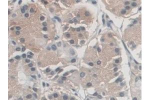 Detection of AZIN1 in Human Stomach Tissue using Polyclonal Antibody to Antizyme Inhibitor 1 (AZIN1) (Antizyme Inhibitor 1 抗体  (AA 5-290))